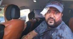 Palestinians and US journalist injured by Israeli settlers in West Bank harvest attack