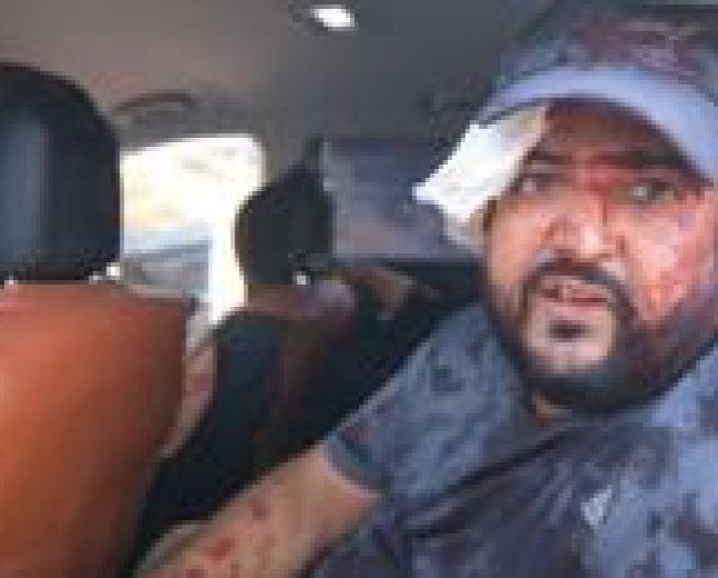 Palestinians and US journalist injured by Israeli settlers in West Bank harvest attack